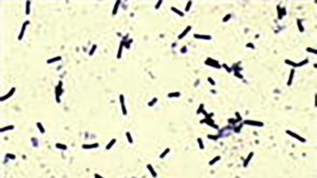 Clostridium Sordellii bacteria under a microscope