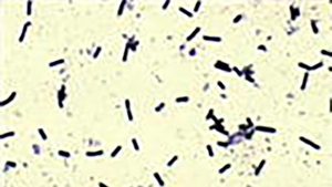 Clostridium Sordellii bacteria under a microscope